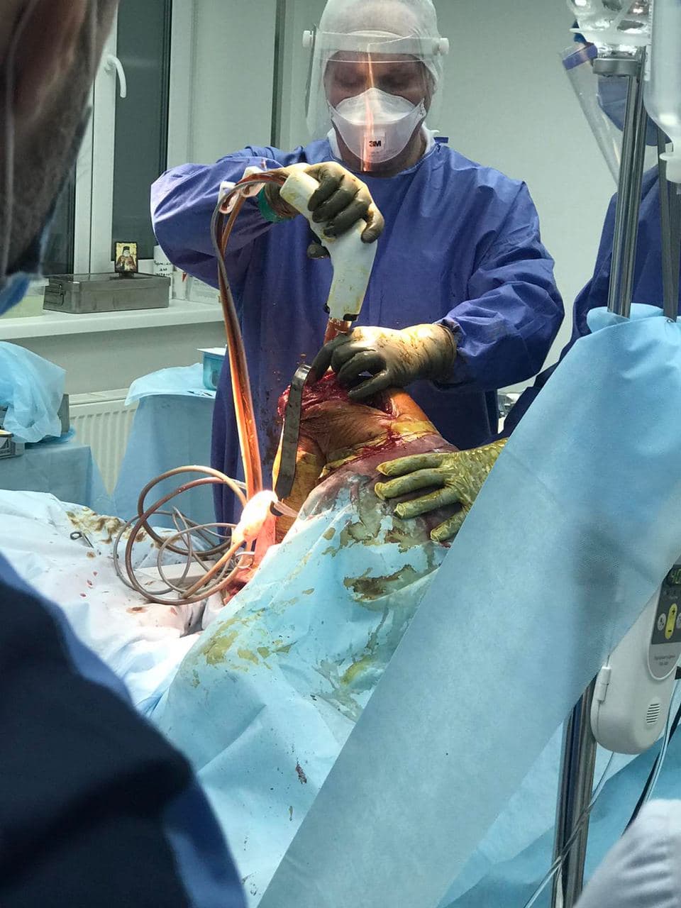 эндопротезирование коленного сустава