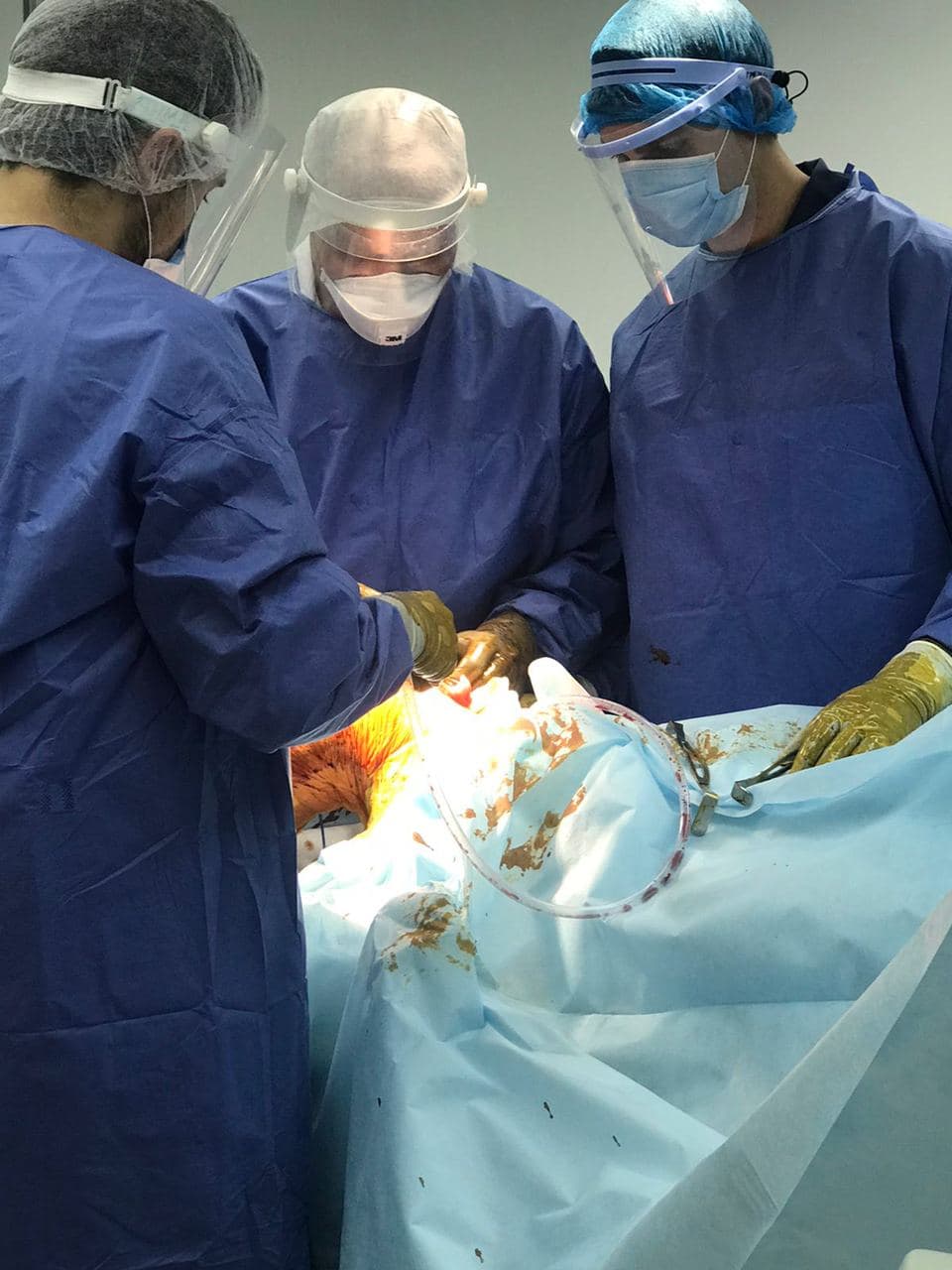 эндопротезирование коленного сустава