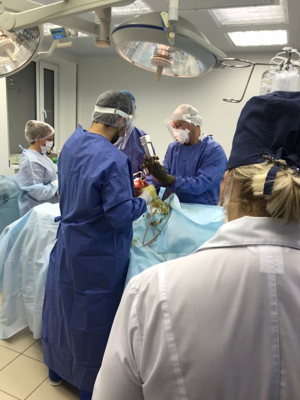 эндопротезирование коленного сустава