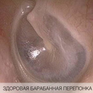 здоровая барабанная перепонка
